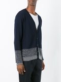 striped button down cardigan