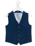 printed waistcoat 