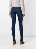 distressed skinny jeans