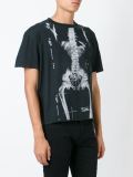 'X-ray'印花T恤