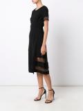 lace detail dress