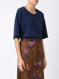 short sleeves body