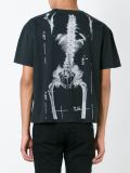 'X-ray'印花T恤