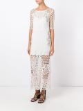 lace dress
