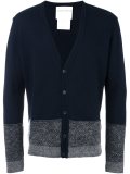 striped button down cardigan