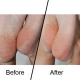 Emjoi MICRO Pedi Unit