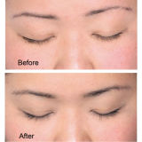 RapidLash Eyelash Enhancing Serum
