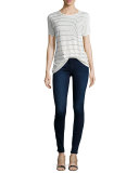 The Icon Skinny Jeans, Frankie