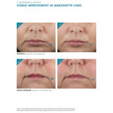 SkinCeuticals H.A Intensifier Treatment 30ml
