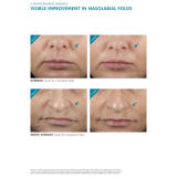 SkinCeuticals H.A Intensifier Treatment 30ml