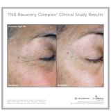 SkinMedica TNS Recovery Complex