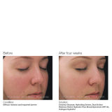 PCA Skin Dual Action Redness Relief